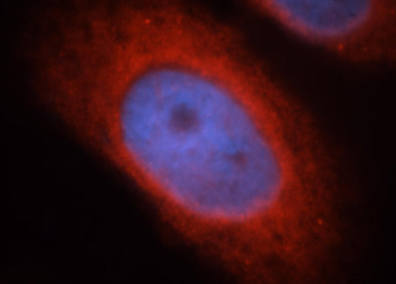 Immunofluorescent analysis of MCF-7 cells, using PTK6 antibody Catalog No:117238 at 1:25 dilution and Rhodamine-labeled goat anti-rabbit IgG (red). Blue pseudocolor = DAPI (fluorescent DNA dye).