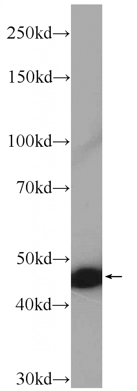 Recombinant protein were subjected to SDS PAGE followed by western blot with Catalog No:111868(IFNA1 Antibody) at dilution of 1:3000
