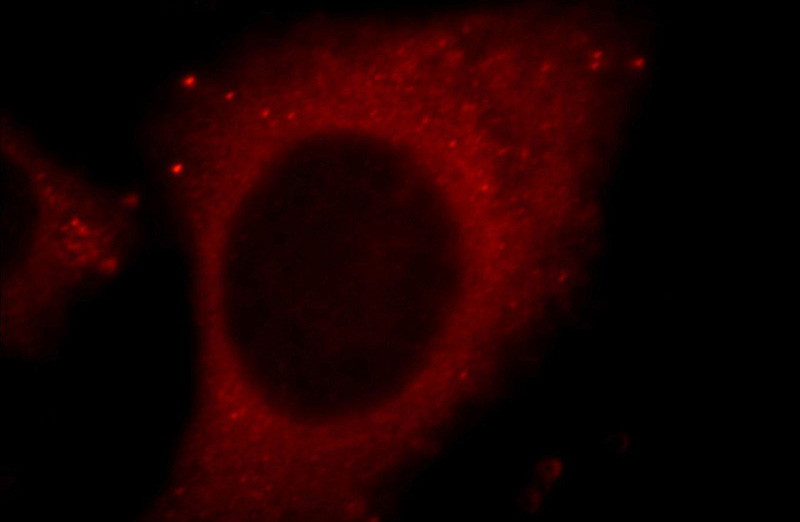 Immunofluorescent analysis of HepG2 cells, using CTSD antibody Catalog No:108888 at 1:25 dilution and Rhodamine-labeled goat anti-rabbit IgG (red).