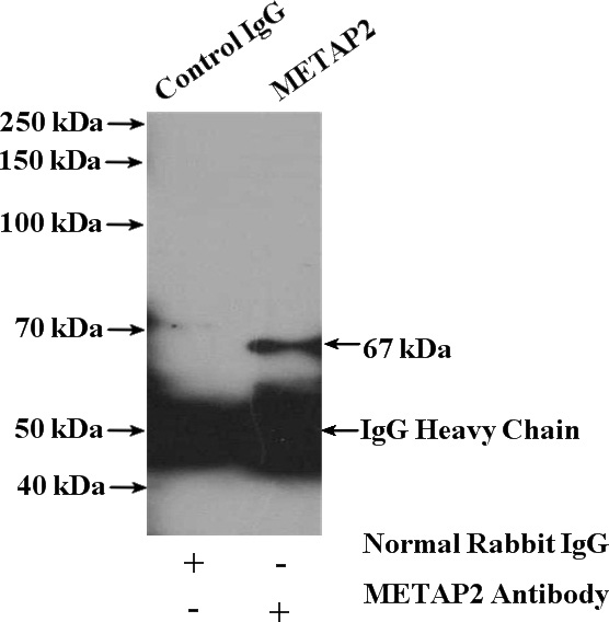IP Result of anti-METAP2 (IP:Catalog No:112514, 4ug; Detection:Catalog No:112514 1:300) with MCF-7 cells lysate 3200ug.