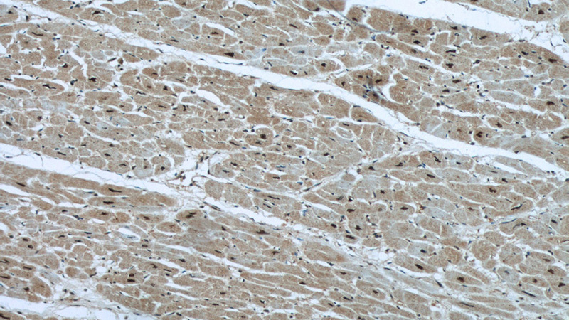 Immunohistochemical of paraffin-embedded human heart using Catalog No:114109(PPP3CA antibody) at dilution of 1:50 (under 10x lens)