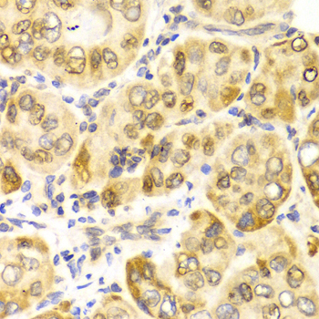 Immunohistochemistry - CPT2 Polyclonal Antibody 