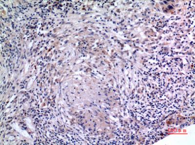 Immunohistochemical analysis of paraffin-embedded human-lung, antibody was diluted at 1:100