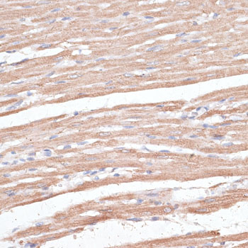 Immunohistochemistry - KCNK1 Polyclonal Antibody 