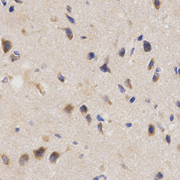 Immunohistochemistry - PPP2R4 Polyclonal Antibody 