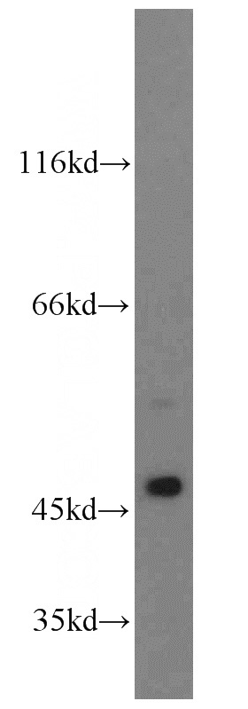 HeLa cells were subjected to SDS PAGE followed by western blot with Catalog No:109796(KRT17 antibody) at dilution of 1:600