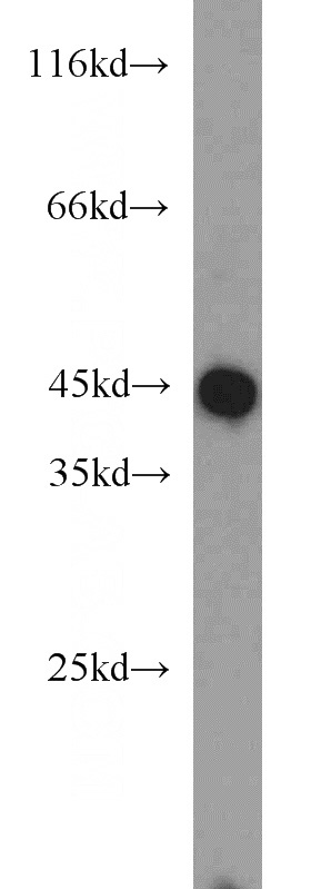 mouse liver tissue were subjected to SDS PAGE followed by western blot with Catalog No:107728(ACAT2 antibody) at dilution of 1:2000