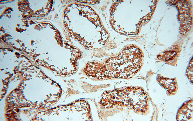 Immunohistochemical of paraffin-embedded human testis using Catalog No:117300(tubulin-Alpha antibody) at dilution of 1:50 (under 10x lens)