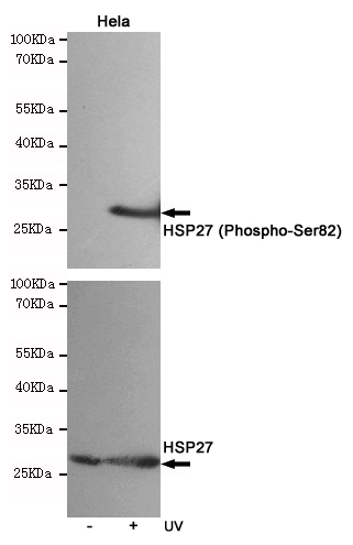 Western blot analysis of extracts from Hela cells, untreated or treated with UV, using HSP27 (Phospho-Ser82) Rabbit pAb (166689,1:500 diluted,upper) or Hsp27 Mouse mAb (200778,lower).