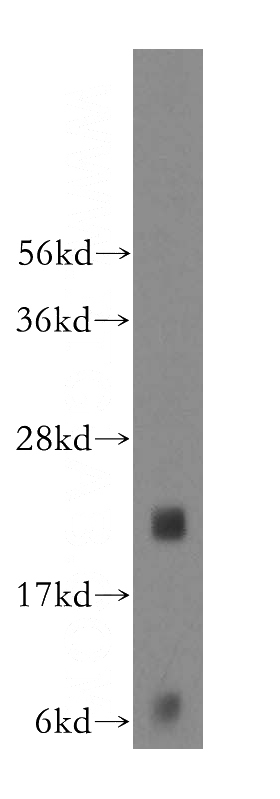 human heart tissue were subjected to SDS PAGE followed by western blot with Catalog No:112590(MED30 antibody) at dilution of 1:200
