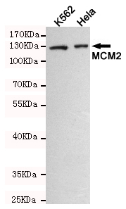 Western blot detection of MCM2 in K562 and Hela cell lysates using MCM2 mouse mAb (dilution 1:500).Predicted band size:125KDa.Observed band size:125KDa.