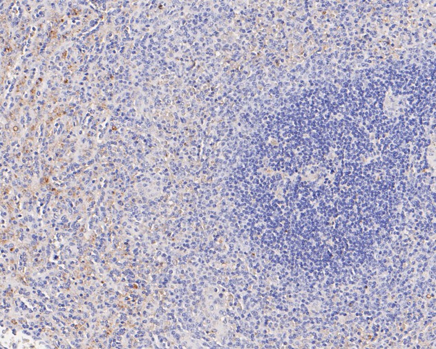 Fig3:; Immunohistochemical analysis of paraffin-embedded human spleen tissue using anti-CD68 antibody. The section was pre-treated using heat mediated antigen retrieval with Tris-EDTA buffer (pH 8.0-8.4) for 20 minutes.The tissues were blocked in 5% BSA for 30 minutes at room temperature, washed with ddH; 2; O and PBS, and then probed with the primary antibody ( 1/200) for 30 minutes at room temperature. The detection was performed using an HRP conjugated compact polymer system. DAB was used as the chromogen. Tissues were counterstained with hematoxylin and mounted with DPX.