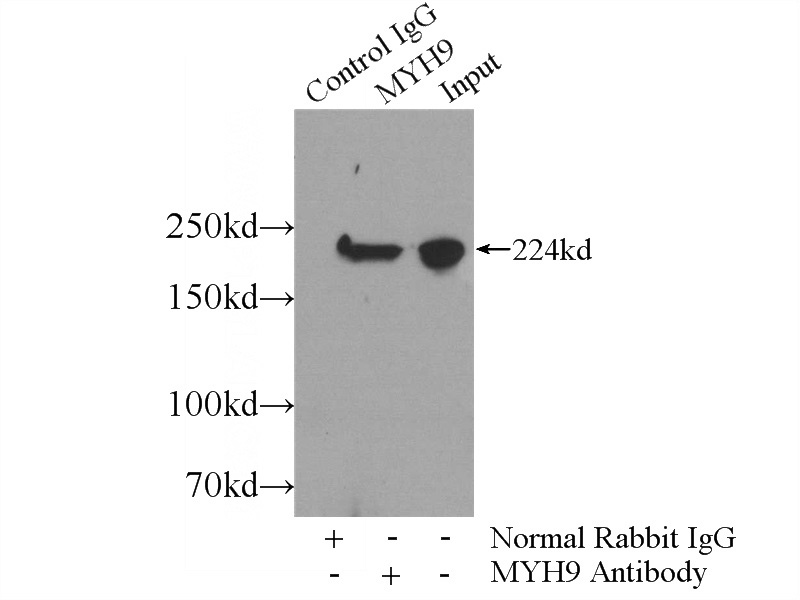 IP Result of anti-MYH9 (IP:Catalog No:112937, 5ug; Detection:Catalog No:112937 1:1000) with mouse brain tissue lysate 4000ug.
