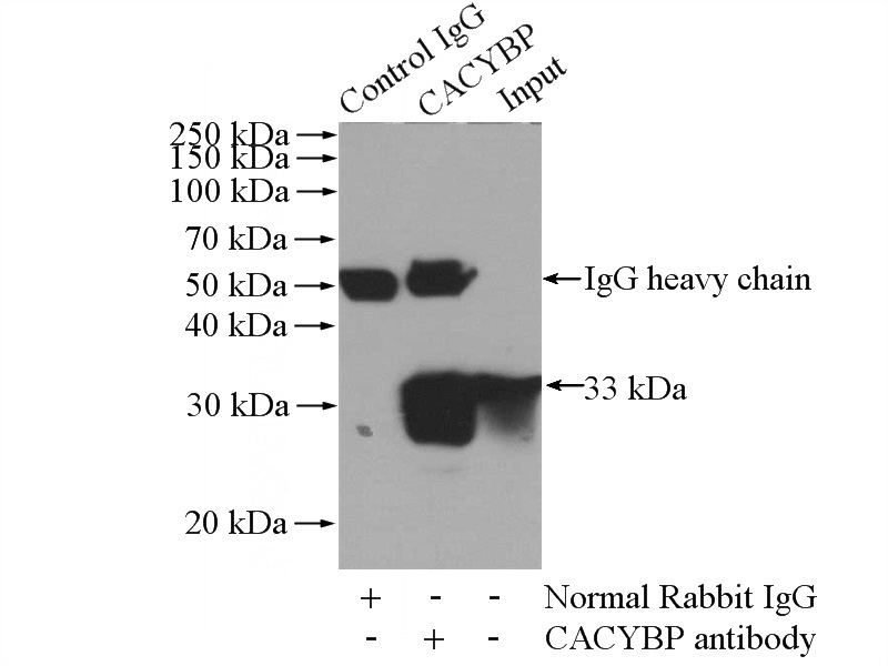 IP Result of anti-CACYBP (IP:Catalog No:108770, 4ug; Detection:Catalog No:108770 1:1000) with mouse brain tissue lysate 4000ug.