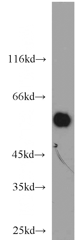 MDA-MB-453s cells were subjected to SDS PAGE followed by western blot with Catalog No:113797(ACCS antibody) at dilution of 1:1000