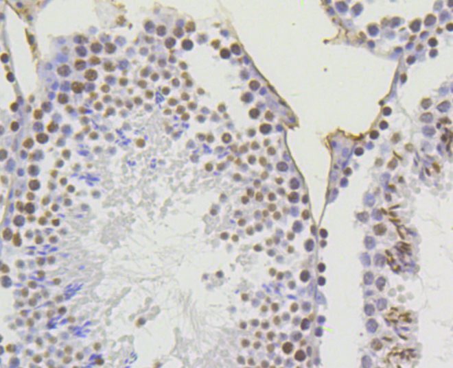Immunohistochemistry - Acetyl-Histone H4-K5 mAb 