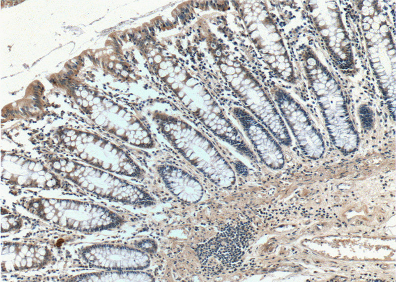 Immunohistochemistry of paraffin-embedded human colon tissue slide using Catalog No:108112(AOAH Antibody) at dilution of 1:50 (under 10x lens)