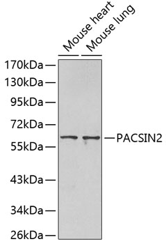 Western blot - PACSIN2 Polyclonal Antibody 