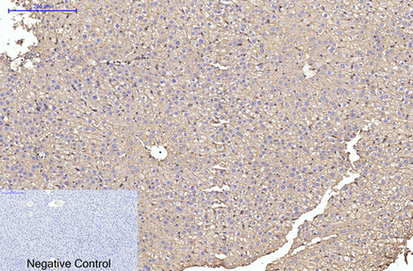 Immunohistochemical analysis of paraffin-embedded Rat-liver tissue. 1,α skeletal muscle actin Monoclonal Antibody was diluted at 1:200(4°C,overnight). 2, Sodium citrate pH 6.0 was used for antibody retrieval(>98°C,20min). 3,Secondary antibody was diluted at 1:200(room tempeRature, 30min). Negative control was used by secondary antibody only.