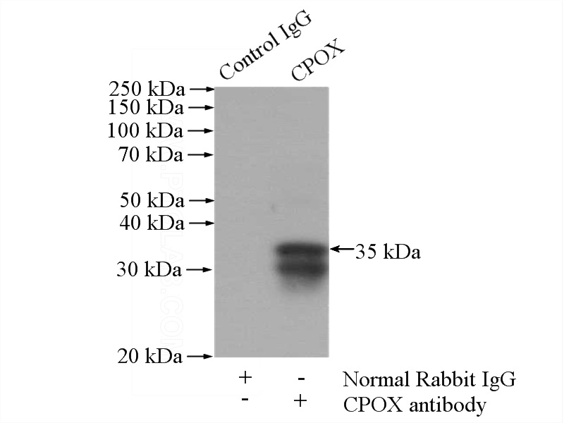 IP Result of anti-CPOX (IP:Catalog No:109461, 4ug; Detection:Catalog No:109461 1:1000) with HepG2 cells lysate 1800ug.