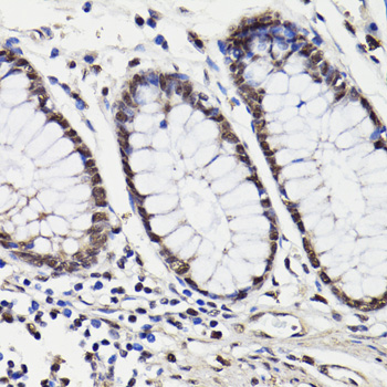 Immunohistochemistry - NAV2 Polyclonal Antibody 