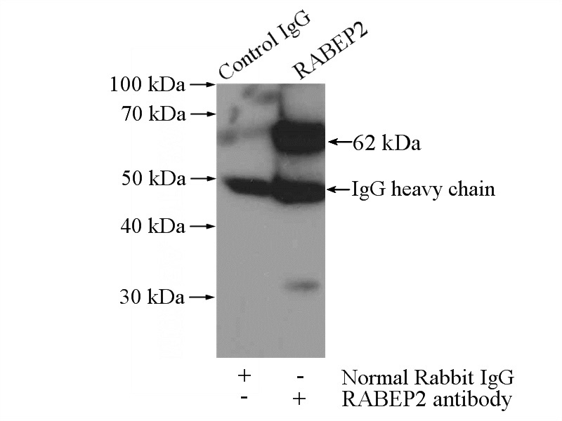 IP Result of anti-RABEP2 (IP:Catalog No:114494, 4ug; Detection:Catalog No:114494 1:1000) with mouse liver tissue lysate 4000ug.