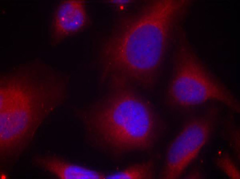Immunofluorescence - Phospho-MARCKS-S158 pAb 