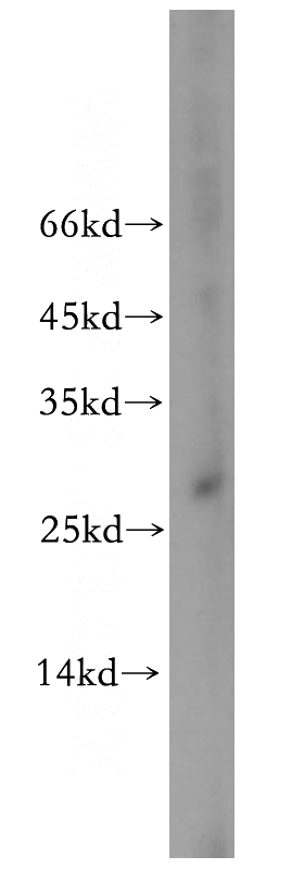 A431 cells were subjected to SDS PAGE followed by western blot with Catalog No:108622(C19orf43 antibody) at dilution of 1:300