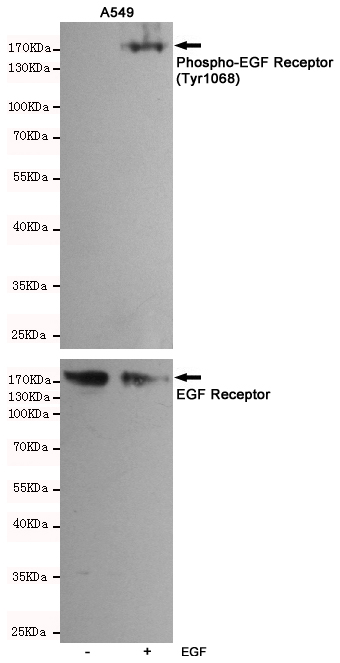 Western blot analysis of extracts of A549 cells, untreated or EGF-stimulated, using Phospho-EGF Receptor (Tyr1068) Rabbit pAb (upper,1:500 diluted) and EGF Receptor Antibody 201012-6H11 (lower,1:500 diluted).
