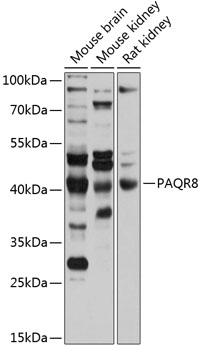 Western blot - PAQR8 Polyclonal Antibody 