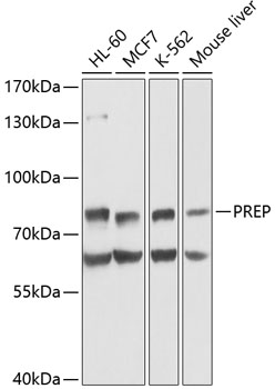 Western blot - PREP Polyclonal Antibody 