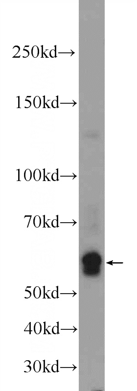 Tunicamycin treated HepG2 cells were subjected to SDS PAGE followed by western blot with Catalog No:110433(F9 Antibody) at dilution of 1:600