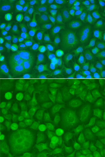 Immunofluorescence - EPM2A Polyclonal Antibody 