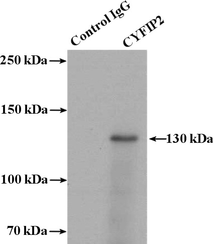 IP Result of anti-CYFIP2 (IP:Catalog No:109676, 4ug; Detection:Catalog No:109676 1:700) with mouse brain tissue lysate 4000ug.