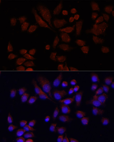 Immunofluorescence - NAT2 Polyclonal Antibody 