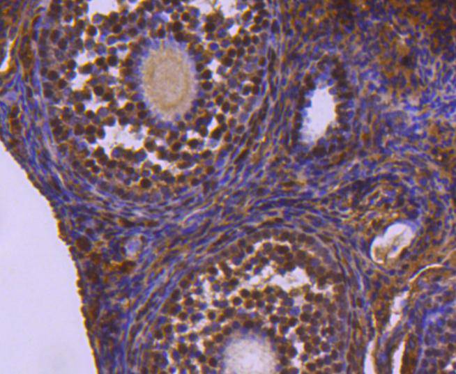 Fig5:; Immunohistochemical analysis of paraffin-embedded mouse ovary tissue using anti-Ubiquitin-like modifier-activating enzyme 1 antibody. The section was pre-treated using heat mediated antigen retrieval with Tris-EDTA buffer (pH 8.0-8.4) for 20 minutes.The tissues were blocked in 5% BSA for 30 minutes at room temperature, washed with ddH; 2; O and PBS, and then probed with the primary antibody ( 1/50) for 30 minutes at room temperature. The detection was performed using an HRP conjugated compact polymer system. DAB was used as the chromogen. Tissues were counterstained with hematoxylin and mounted with DPX.