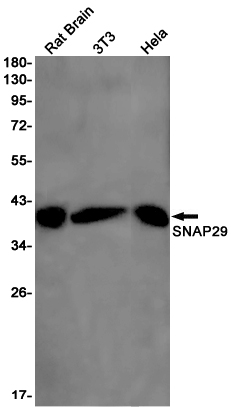 Western blot detection of SNAP29 in Rat Brain,3T3,Hela cell lysates using SNAP29 Rabbit pAb(1:1000 diluted).Predicted band size:29kDa.Observed band size:29kDa.