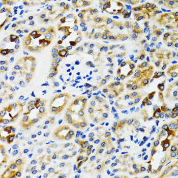 Immunohistochemistry - RPN1 Polyclonal Antibody 