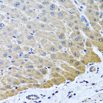 Immunohistochemistry - ARSF Polyclonal Antibody 
