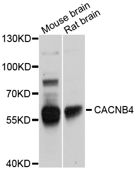Western blot - CACNB4 Polyclonal Antibody 