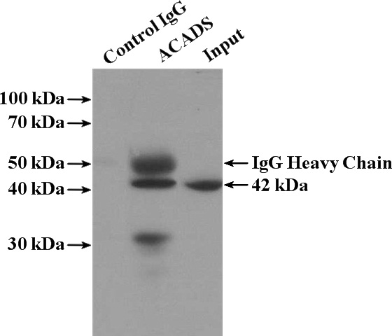 IP Result of anti-ACADS (IP:Catalog No:107721, 4ug; Detection:Catalog No:107721 1:500) with HEK-293 cells lysate 3000ug.