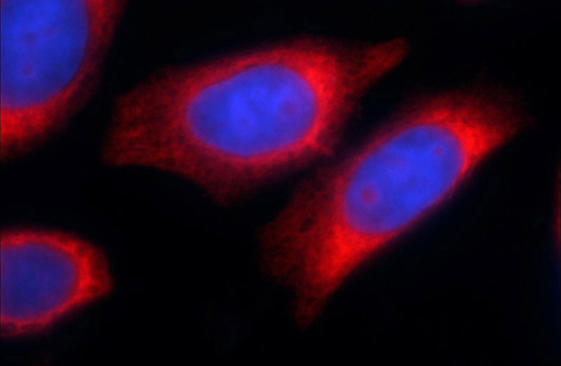Immunofluorescent analysis of HeLa cells using Catalog No:114877(RPL22 Antibody) at dilution of 1:50 and Rhodamine-Goat anti-Rabbit IgG