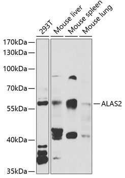 Western blot - ALAS2 Polyclonal Antibody 