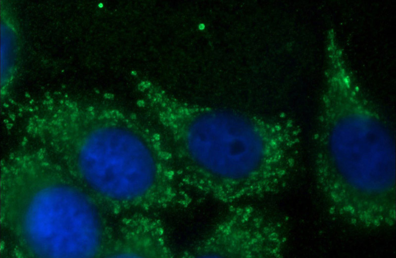 Immunofluorescent analysis of HepG2 cells using Catalog No:114906(RPLP1 Antibody) at dilution of 1:50 and Alexa Fluor 488-congugated AffiniPure Goat Anti-Rabbit IgG(H+L)