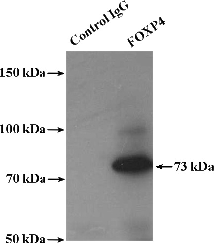 IP Result of anti-FOXP4 (IP:Catalog No:110712, 4ug; Detection:Catalog No:110712 1:300) with mouse lung tissue lysate 4000ug.