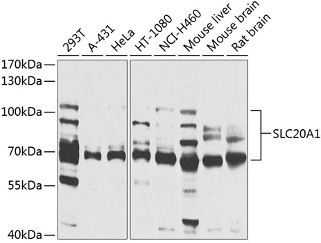 Western blot - SLC20A1 Polyclonal Antibody 