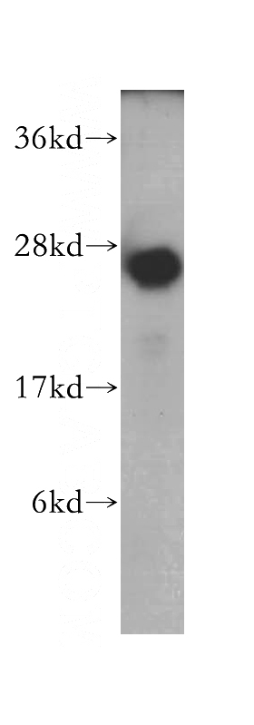 MCF7 cells were subjected to SDS PAGE followed by western blot with Catalog No:108240(ARD1A antibody) at dilution of 1:500