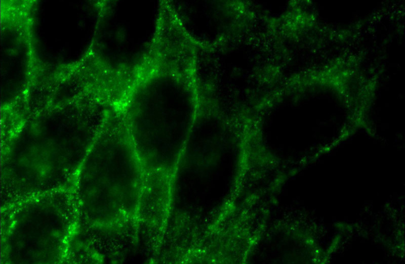 Immunofluorescent analysis of HeLa cells using Catalog No:109478(Cortactin Antibody) at dilution of 1:50 and Alexa Fluor 488-congugated AffiniPure Goat Anti-Rabbit IgG(H+L)