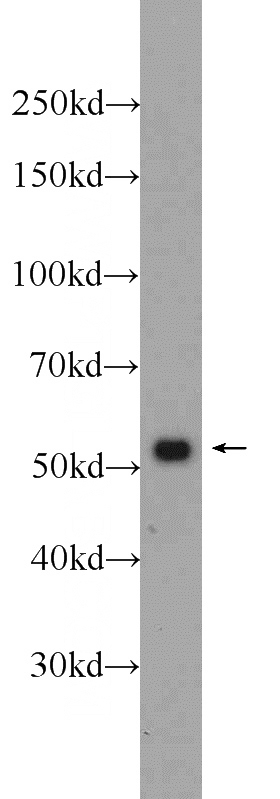 NIH/3T3 cells were subjected to SDS PAGE followed by western blot with Catalog No:116753(VIM antibody) at dilution of 1:2000