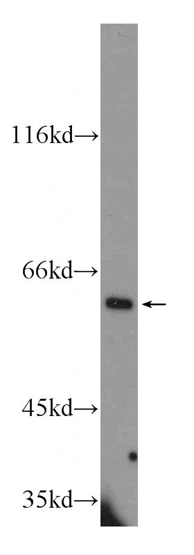 Y79 cells were subjected to SDS PAGE followed by western blot with Catalog No:116022(BIGH3 Antibody) at dilution of 1:600
